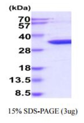 SDS-PAGE (CDK5-236H).jpg